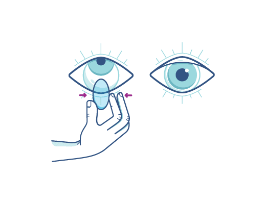 Removing Contact Lens